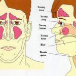 Những điều cần biết về bệnh viêm mũi, viêm xoang